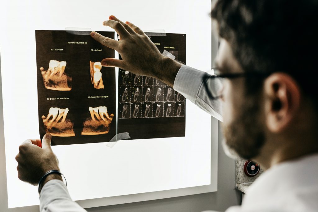X-Ray Analysis