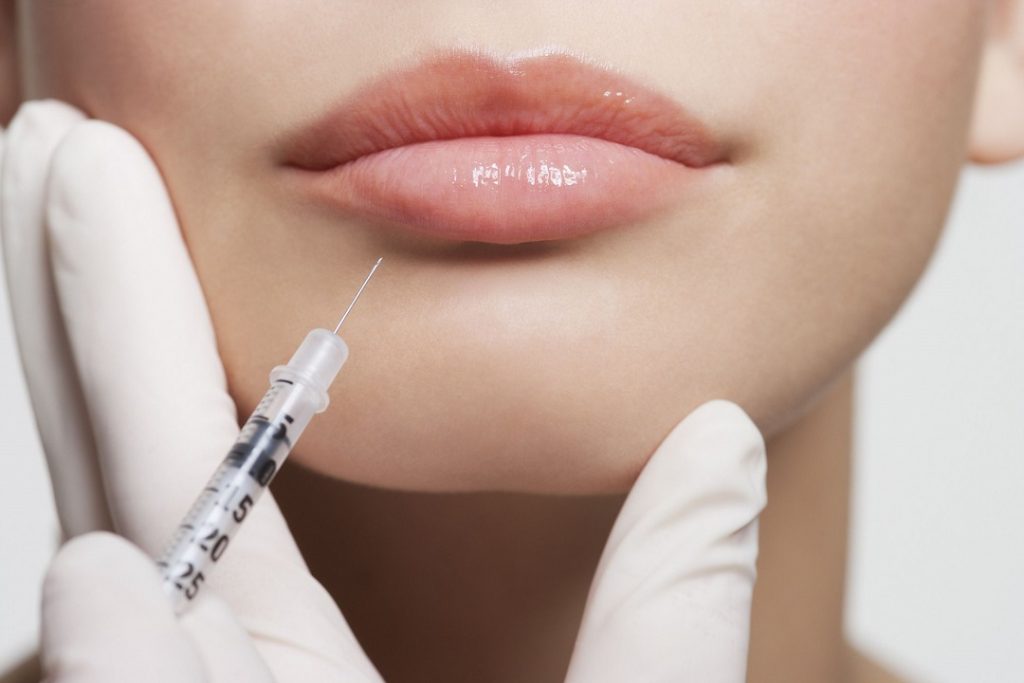 Juvederm injection