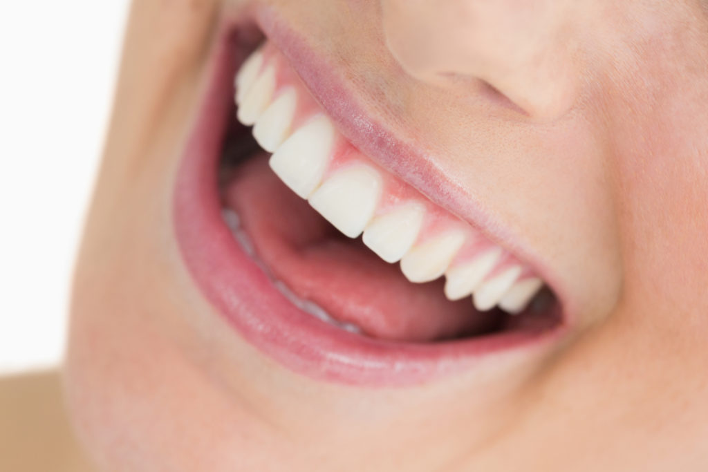 Getting a Dental Implant in Dubai Best Dental Implant Clinic