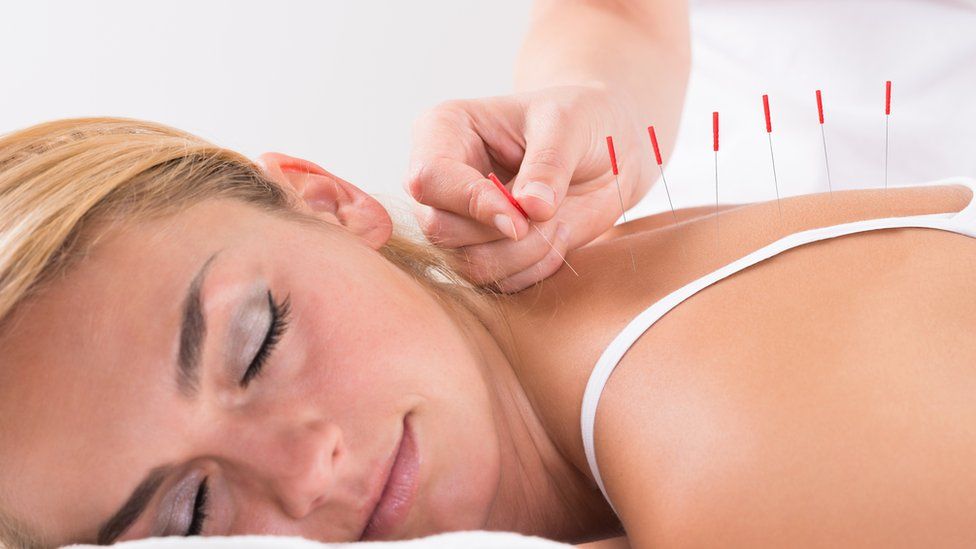 What Health Conditions Can Benefit from Acupuncture in Singapore? Acupuncture Singapore